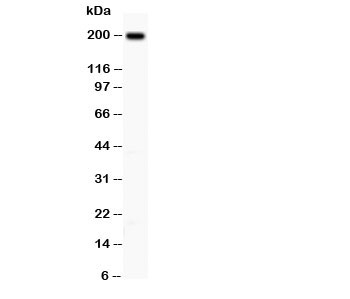 ITGB4 / Integrin Beta 4 Antibody - Western blot testing of Integrin beta 4 antibody and A431 lysate; Predicted size: 200KD; Observed size: 200KD