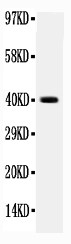 ITGB4 / Integrin Beta 4 Antibody - WB of ITGB4 / Integrin Beta 4 antibody. All lanes: Anti-ITGB4 at 0.5ug/ml. WB: Recombinant Human Integrin beta4 Protein 0.5ng. Predicted bind size: 40KD. Observed bind size: 40KD.