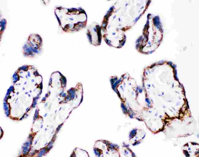 ITGB4 / Integrin Beta 4 Antibody - IHC analysis of ITGB4 using anti-ITGB4 antibody. ITGB4 was detected in paraffin-embedded section of human placenta tissues. Heat mediated antigen retrieval was performed in citrate buffer (pH6, epitope retrieval solution) for 20 mins. The tissue section was blocked with 10% goat serum. The tissue section was then incubated with 1µg/ml rabbit anti-ITGB4 Antibody overnight at 4°C. Biotinylated goat anti-rabbit IgG was used as secondary antibody and incubated for 30 minutes at 37°C. The tissue section was developed using Strepavidin-Biotin-Complex (SABC) with DAB as the chromogen.