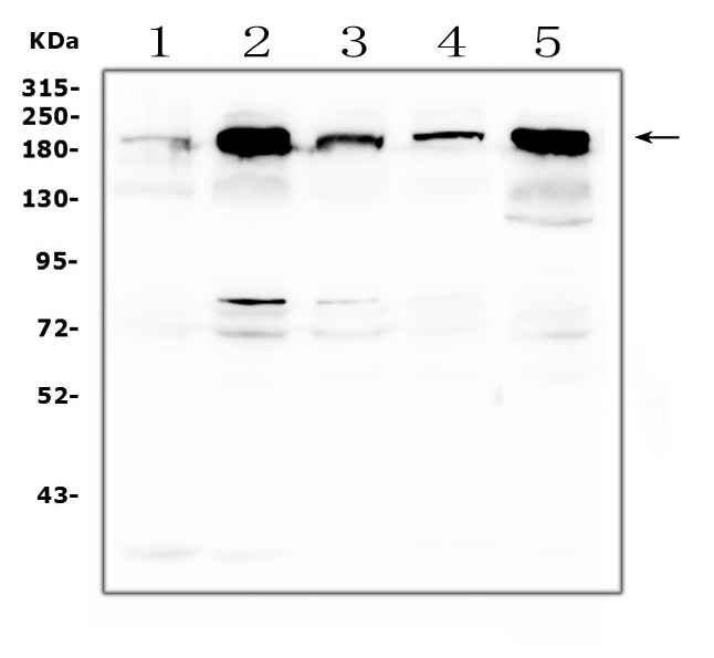 ITGB4 / Integrin Beta 4 Antibody - Western blot analysis of ITGB4 using anti-ITGB4 antibody. Electrophoresis was performed on a 5-20% SDS-PAGE gel at 70V (Stacking gel) / 90V (Resolving gel) for 2-3 hours. The sample well of each lane was loaded with 50ug of sample under reducing conditions. Lane 1: human A549 whole cell lysates, Lane 2: human PC-3 whole cell lysates, Lane 3: human T-47D whole cell lysates, Lane 4: human Hela whole cell lysates. Lane 5: human Caco-2 whole cell lysates. After Electrophoresis, proteins were transferred to a Nitrocellulose membrane at 150mA for 50-90 minutes. Blocked the membrane with 5% Non-fat Milk/ TBS for 1.5 hour at RT. The membrane was incubated with rabbit anti-ITGB4 antigen affinity purified polyclonal antibody at 0.5 µg/mL overnight at 4°C, then washed with TBS-0.1% Tween 3 times with 5 minutes each and probed with a goat anti-rabbit IgG-HRP secondary antibody at a dilution of 1:10000 for 1.5 hour at RT. The signal is developed using an Enhanced Chemiluminescent detection (ECL) kit with Tanon 5200 system. A specific band was detected for ITGB4 at approximately 202KD. The expected band size for ITGB4 is at 202KD.