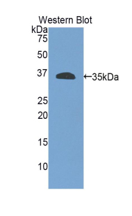ITGB4 / Integrin Beta 4 Antibody - Western blot of recombinant ITGB4 / Integrin Beta 4.  This image was taken for the unconjugated form of this product. Other forms have not been tested.