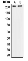 ITGB4 / Integrin Beta 4 Antibody - Western blot analysis of CD104 expression in A431 (A); SW480 (B) whole cell lysates.