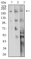 ITGB4 / Integrin Beta 4 Antibody - Western blot analysis using CD104 mouse mAb against A549 (1), A431 (2), and SW620 (3) cell lysate.