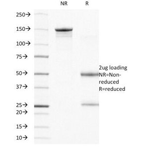 ITGB4 / Integrin Beta 4 Antibody - SDS-PAGE Analysis of Purified, BSA-Free Integrin Beta-4 Antibody (clone UM-A9). Confirmation of Integrity and Purity of the Antibody.