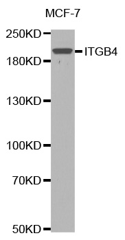 ITGB4 / Integrin Beta 4 Antibody - Western blot analysis of extracts of MCF7 cells lines, using ITGB4 antibody.