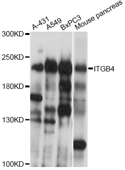 ITGB4 / Integrin Beta 4 Antibody - Western blot analysis of extracts of various cell lines, using ITGB4 antibody at 1:1000 dilution. The secondary antibody used was an HRP Goat Anti-Rabbit IgG (H+L) at 1:10000 dilution. Lysates were loaded 25ug per lane and 3% nonfat dry milk in TBST was used for blocking. An ECL Kit was used for detection and the exposure time was 10s.