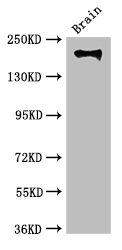 ITGB4 / Integrin Beta 4 Antibody - Positive WB detected in:Mouse brain tissue;All lanes:ITGB4 antibody at 3.5ug/ml;Secondary;Goat polyclonal to rabbit IgG at 1/50000 dilution;Predicted band size: 203,196,201,195,107 kDa;Observed band size: 203 kDa;