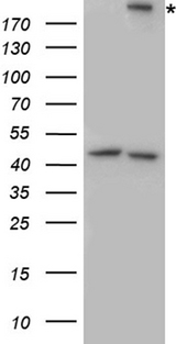 ITGB4 / Integrin Beta 4 Antibody - HEK293T cells were transfected with the pCMV6-ENTRY control. (Left lane) or pCMV6-ENTRY ITGB4. (Right lane) cDNA for 48 hrs and lysed