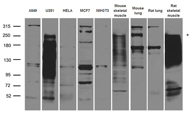 ITGB4 / Integrin Beta 4 Antibody - Western blot analysis of extracts. (35ug) from different cell lines and tissues by using anti-ITGB4 rabbit polyclonal antibody.