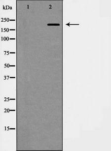 ITGB4 / Integrin Beta 4 Antibody - Western blot analysis of Integrin Beta4 expression in HepG2 cells. The lane on the left is treated with the antigen-specific peptide.
