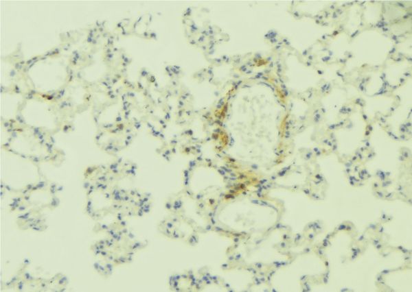ITGB4 / Integrin Beta 4 Antibody - 1:100 staining human lung tissue by IHC-P. The sample was formaldehyde fixed and a heat mediated antigen retrieval step in citrate buffer was performed. The sample was then blocked and incubated with the antibody for 1.5 hours at 22°C. An HRP conjugated goat anti-rabbit antibody was used as the secondary.