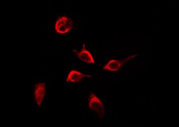 ITGB4 / Integrin Beta 4 Antibody - Staining HepG2 cells by IF/ICC. The samples were fixed with PFA and permeabilized in 0.1% Triton X-100, then blocked in 10% serum for 45 min at 25°C. The primary antibody was diluted at 1:200 and incubated with the sample for 1 hour at 37°C. An Alexa Fluor 594 conjugated goat anti-rabbit IgG (H+L) Ab, diluted at 1/600, was used as the secondary antibody.