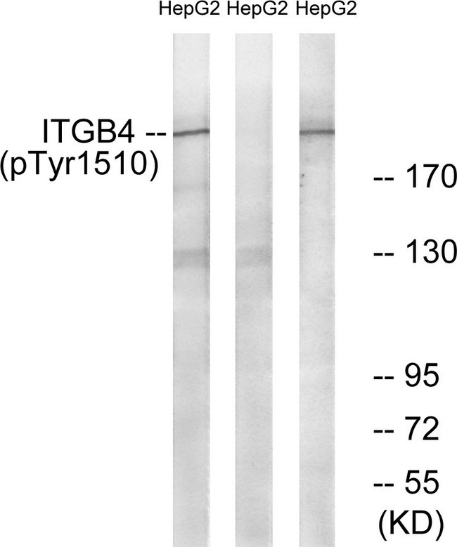 ITGB4 / Integrin Beta 4 Antibody - Western blot analysis of lysates from HepG2 cells treated with Na2VO3 0.3nM 40', using ITGB4 (Phospho-Tyr1510) Antibody. The lane on the right is blocked with the phospho peptide.