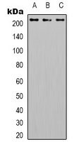 ITGB4 / Integrin Beta 4 Antibody - Western blot analysis of CD104 (pY1510) expression in HepG2 (A); SW480 (B); A431 (C) whole cell lysates.