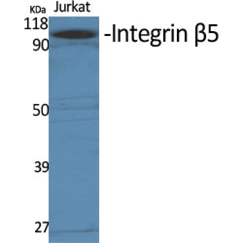 ITGB5 / Integrin Beta 5 Antibody - Western blot of Integrin beta5 antibody