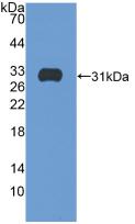 ITGB5 / Integrin Beta 5 Antibody - Western Blot; Sample: Recombinant ITGb5, Human.