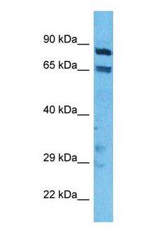 ITGB5 / Integrin Beta 5 Antibody - Western blot of ITB5 Antibody with human A549 Whole Cell lysate.  This image was taken for the unconjugated form of this product. Other forms have not been tested.