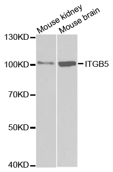 ITGB5 / Integrin Beta 5 Antibody - Western blot analysis of extracts of various cell lines, using ITGB5 antibody.