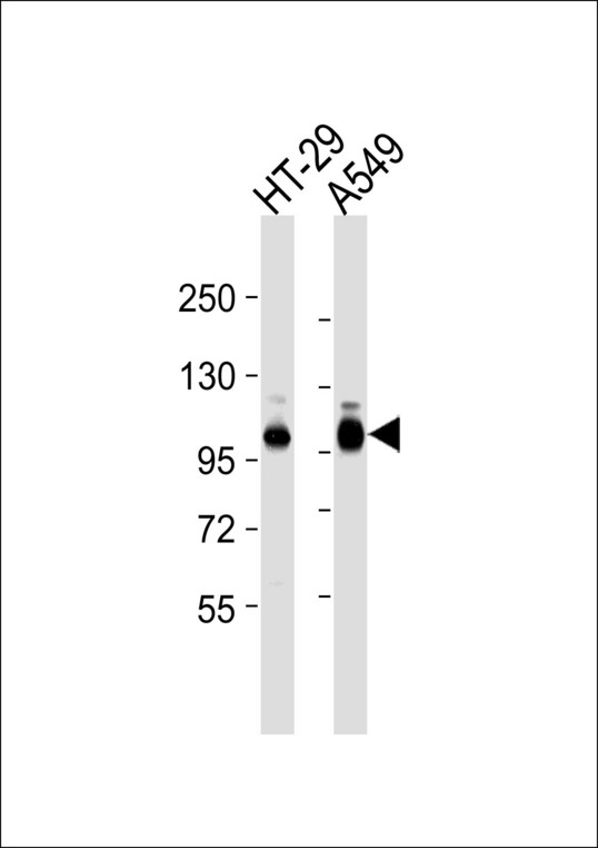 ITGB5 / Integrin Beta 5 Antibody - All lanes : Anti-Integrin beta 5 Antibody at 1:1000 dilution Lane 1: HT-29 whole cell lysates Lane 2: A549 whole cell lysates Lysates/proteins at 20 ug per lane. Secondary Goat Anti-Rabbit IgG, (H+L),Peroxidase conjugated at 1/10000 dilution Predicted band size : 88 kDa Blocking/Dilution buffer: 5% NFDM/TBST.