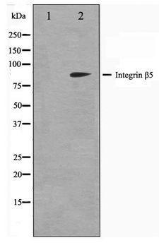 ITGB5 / Integrin Beta 5 Antibody - Western blot of COS7 cell lysate using Integrin beta-5 Antibody