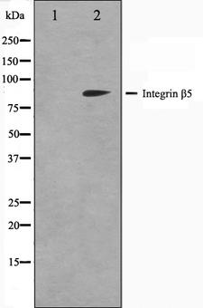 ITGB5 / Integrin Beta 5 Antibody - Western blot analysis on COS7 cell lysates using Integrin beta-5 antibody. The lane on the left is treated with the antigen-specific peptide.