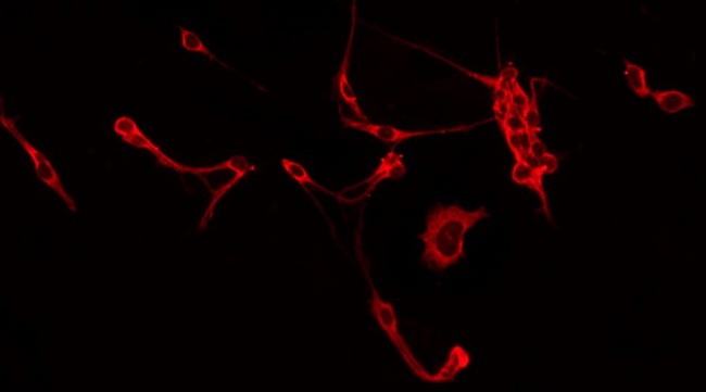 ITGB5 / Integrin Beta 5 Antibody - Staining HeLa cells by IF/ICC. The samples were fixed with PFA and permeabilized in 0.1% Triton X-100, then blocked in 10% serum for 45 min at 25°C. The primary antibody was diluted at 1:200 and incubated with the sample for 1 hour at 37°C. An Alexa Fluor 594 conjugated goat anti-rabbit IgG (H+L) Ab, diluted at 1/600, was used as the secondary antibody.