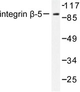 ITGB5 / Integrin Beta 5 Antibody - Western blot of Integrin 5 (V746) pAb in extracts from COS7 cells.
