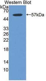 ITGB6 / Integrin Beta 6 Antibody - Western blot using recombinant ITGB6 / Integrin Beta 6 encoding aa 131-619,