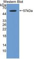 ITGB6 / Integrin Beta 6 Antibody - Western blot using recombinant ITGB6 / Integrin Beta 6 encoding aa 131-619,