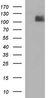 ITGB6 / Integrin Beta 6 Antibody - HEK293T cells were transfected with the pCMV6-ENTRY control (Left lane) or pCMV6-ENTRY ITGB6 (Right lane) cDNA for 48 hrs and lysed. Equivalent amounts of cell lysates (5 ug per lane) were separated by SDS-PAGE and immunoblotted with anti-ITGB6.