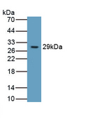 ITGB6 / Integrin Beta 6 Antibody - Western Blot Sample: Recombinant ITGb6, Human