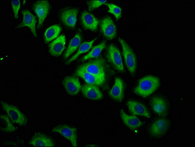 ITGB6 / Integrin Beta 6 Antibody - Immunofluorescence staining of A549 cells at a dilution of 1:133, counter-stained with DAPI. The cells were fixed in 4% formaldehyde, permeabilized using 0.2% Triton X-100 and blocked in 10% normal Goat Serum. The cells were then incubated with the antibody overnight at 4°C.The secondary antibody was Alexa Fluor 488-congugated AffiniPure Goat Anti-Rabbit IgG (H+L) .