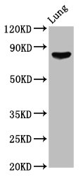 ITGB6 / Integrin Beta 6 Antibody - Positive Western Blot detected in Rat lung tissue. All lanes: ITGB6 antibody at 6.12 µg/ml Secondary Goat polyclonal to rabbit IgG at 1/50000 dilution. Predicted band size: 86, 75 KDa. Observed band size: 86 KDa