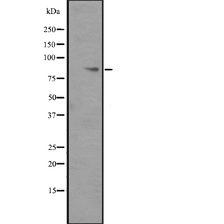 ITGB6 / Integrin Beta 6 Antibody - Western blot analysis of ITGB6 expression in ITGB6 transfected 293T cells lysate. The lane on the left is treated with the antigen-specific peptide.