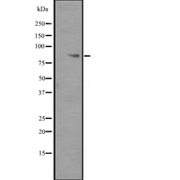 ITGB6 / Integrin Beta 6 Antibody - Western blot analysis of ITGB6 expression in ITGB6 transfected 293T cells lysate. The lane on the left is treated with the antigen-specific peptide.