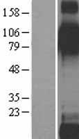 ITGB6 / Integrin Beta 6 Protein - Western validation with an anti-DDK antibody * L: Control HEK293 lysate R: Over-expression lysate