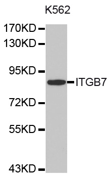 ITGB7 / Integrin Beta 7 Antibody - Western blot analysis of extracts of K-562 cell line, using ITGB7 Antibody.