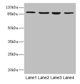 ITGB7 / Integrin Beta 7 Antibody - Western blot All Lanes: ITGB7 antibody at 5.04ug/ml Lane 1: MCF7 whole cell lysate Lane 2: HepG-2 whole cell lysate Lane 3: A549 whole cell lysate Lane 4: K562 whole cell lysate Secondary Goat polyclonal to rabbit IgG at 1/10000 dilution Predicted band size: 87,72 kDa Observed band size: 87 kDa