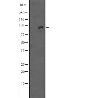 ITGB7 / Integrin Beta 7 Antibody - Western blot analysis of ITGB7 expression in A431 whole cells lysate. The lane on the left is treated with the antigen-specific peptide.