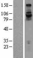 ITGB7 / Integrin Beta 7 Protein - Western validation with an anti-DDK antibody * L: Control HEK293 lysate R: Over-expression lysate
