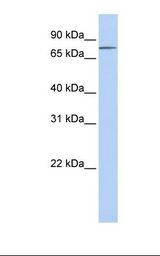 ITGB8 / Integrin Beta 8 Antibody - Placenta lysate. Antibody concentration: 1.0 ug/ml. Gel concentration: 12%.