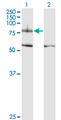 ITGB8 / Integrin Beta 8 Antibody - Western Blot analysis of ITGB8 expression in transfected 293T cell line by ITGB8 monoclonal antibody (M01), clone 2B4.Lane 1: ITGB8 transfected lysate(85.6 KDa).Lane 2: Non-transfected lysate.