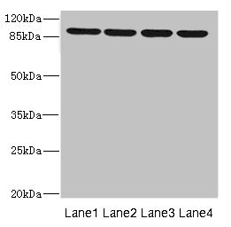 ITGB8 / Integrin Beta 8 Antibody - Western blot All Lanes: ITGB8 antibody at 1.52ug/ml Lane 1: 293T whole cell lysate Lane 2: Hela whole cell lysate Lane 3: HepG-2 whole cell lysate Lane 4: A549 whole cell lysate Secondary Goat polyclonal to rabbit IgG at 1/10000 dilution Predicted band size: 86,72 kDa Observed band size: 82 kDa