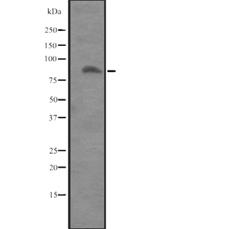 ITGB8 / Integrin Beta 8 Antibody - Western blot analysis of ITGB8 expression in Placenta lysate. The lane on the left is treated with the antigen-specific peptide.