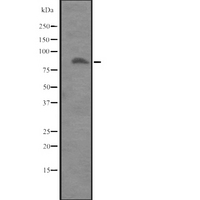 ITGB8 / Integrin Beta 8 Antibody - Western blot analysis of ITGB8 expression in Placenta lysate. The lane on the left is treated with the antigen-specific peptide.