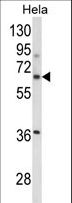 ITGBL1 Antibody - Western blot of ITGBL1 Antibody in HeLa cell line lysates (35 ug/lane). ITGBL1 (arrow) was detected using the purified antibody.