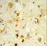 ITGBL1 Antibody - Formalin-fixed and paraffin-embedded human brain tissue reacted with ITGBL1 Antibody , which was peroxidase-conjugated to the secondary antibody, followed by DAB staining. This data demonstrates the use of this antibody for immunohistochemistry; clinical relevance has not been evaluated.