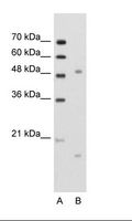 ITGBL1 Antibody - A: Marker, B: Jurkat Cell Lysate.  This image was taken for the unconjugated form of this product. Other forms have not been tested.