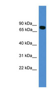 ITIH1 Antibody - ITIH1 antibody Western blot of HepG2 cell lysate. This image was taken for the unconjugated form of this product. Other forms have not been tested.