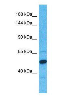 ITIH1 Antibody - Western blot of ITIH1 Antibody with human Fetal Kidney lysate.  This image was taken for the unconjugated form of this product. Other forms have not been tested.